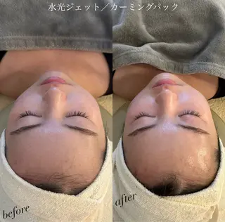 うなじ脱毛/美肌脱毛 LABELのエステ・リラクイメージ