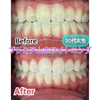 プラチナムビューティー柏所属・【歯科提携】柏ホワイ トニングスタイルのその他イメージ