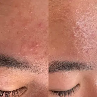 VERY VERY九条店所属・ベリーベリー🌹 九条店のエステ・リラクイメージ