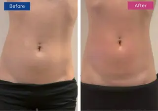 美容鍼/ヘッドスパ/ 💎さかもとのエステ・リラクイメージ