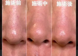 NaKid マツエク&マツパのマツエク・マツパデザイン