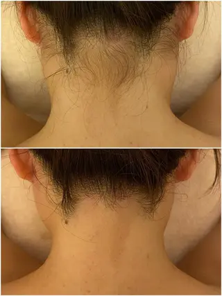 ✨美肌水光✨ アトリエリュバンのエステ・リラクイメージ