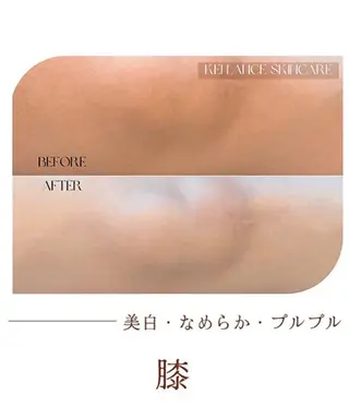 【フェイシャル·脱毛·小顔】BEAUTY HUB所属・BEAUTY HUB小顔·アロマのエステ・リラクイメージ