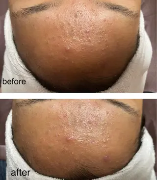 B.glossy所属・ビューティーサロン B.glossyのネイルデザイン