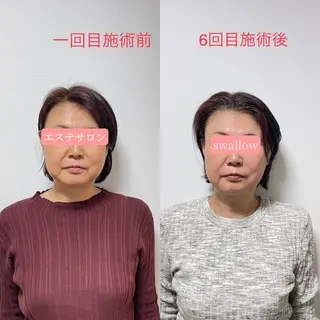 エステサロン swallowのエステ・リラクイメージ