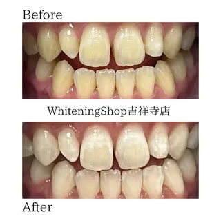 ホワイトニング専門店 御殿山/吉祥寺店のその他イメージ