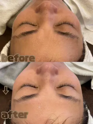 aroma  YURARI所属・韓国艶美人// 毛穴ケア🌹のエステ・リラクイメージ