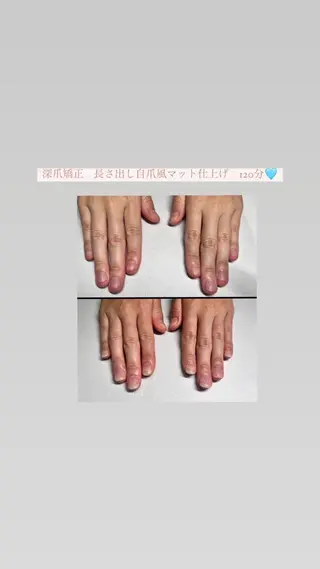 メンズ ネイル 爪ケア/深爪 自爪育成 🐰えむのネイルデザイン