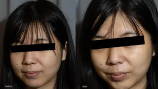 中山 秀展のエステ・リラクイメージ