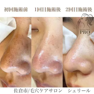 シェリール✳︎ Erinaのマツエク・マツパデザイン