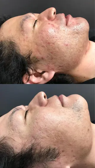 Lilyboo 池袋のエステ・リラクイメージ