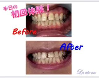 セルフホワイトニングサロン　ラヴィアン所属・ホワイトニングサロン La vie enのその他イメージ