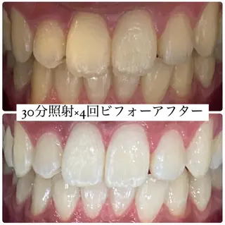 PLATINUM Beauty 横浜店所属・ホワイトニングルーム 横浜店のその他イメージ