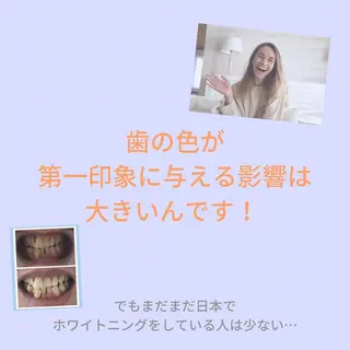 メンズ お手軽ホワイトニングsalon mina所属・武元 奈津美のその他イメージ