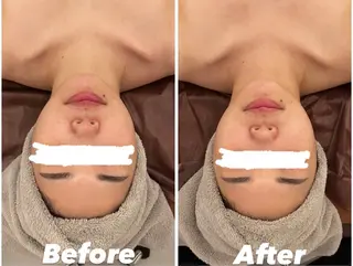 美PLACE所属・m oecaのエステ・リラクイメージ