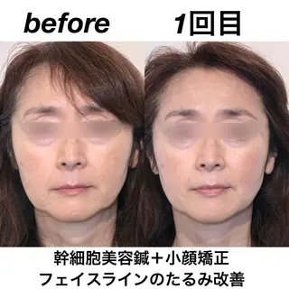 経堂鍼灸整体院 古木のエステ・リラクイメージ