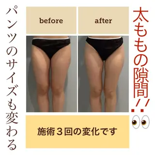 エステサロン JURISのエステ・リラクイメージ