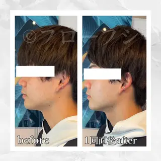 部分痩せ♥️小顔専門 MIKUのエステ・リラクイメージ