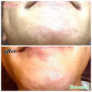メンズ 脱毛＆フェイシャル　Beroad【ビロード】美道所属・脱毛＆フェイシャル Beroad  美道のエステ・リラクイメージ