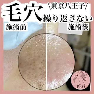 毛穴肌育専門店 リールのエステ・リラクイメージ