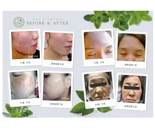 FLEUR大阪・美容 整体・痩身・小顔のエステ・リラクイメージ