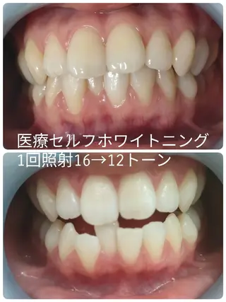 ホワイトアザブ WhiteAzabuのマツエク・マツパデザイン