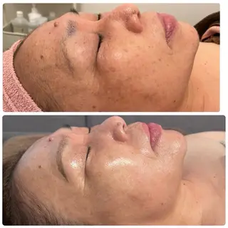 Beauty salon 705のエステ・リラクイメージ