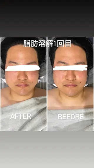 毛穴洗浄・痩身・脱毛 /アルカンジュのエステ・リラクイメージ