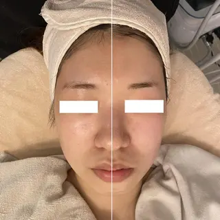 ✨美肌水光✨ アトリエリュバンのエステ・リラクイメージ