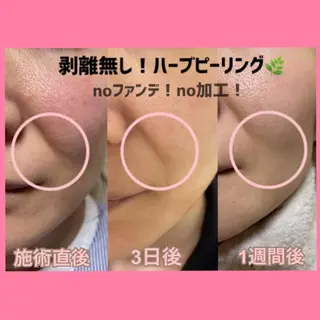 肌ケア＆毛穴洗浄 Cheriのエステ・リラクイメージ