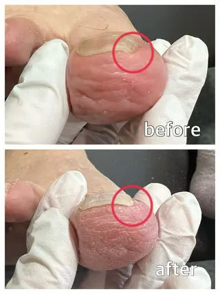 ネイル 巻き爪補正店 堺東店のネイルデザイン