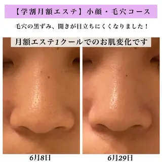 Bellesthe (ベルエステ)のエステ・リラクイメージ