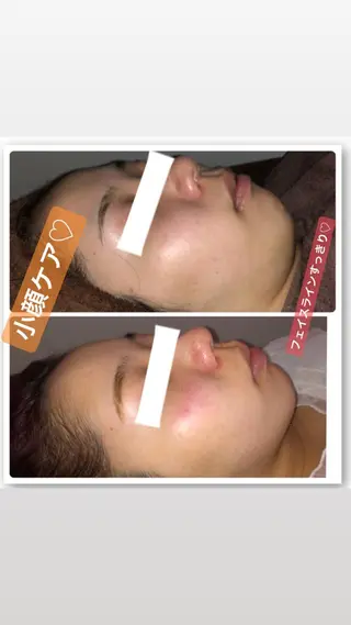 FLEUR大阪・美容 整体・痩身・小顔のエステ・リラクイメージ