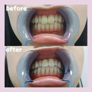 メンズ セルフホワイトニングサロンPalet【パレ】所属・太田 菜那のその他イメージ