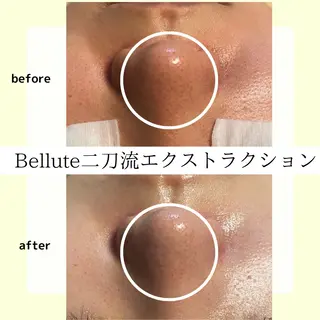 ピーリング専門店 Belluteのエステ・リラクイメージ