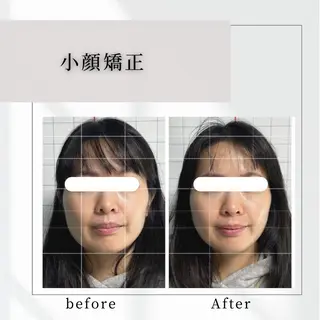 小顔矯正専門店 【RED】池田のエステ・リラクイメージ
