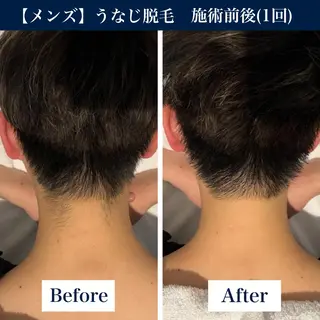 メンズ 【メンズ脱毛・美肌】 SARA 恵比寿店のエステ・リラクイメージ