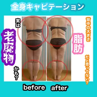 痩身/脱毛/ネイル HARUKAのエステ・リラクイメージ