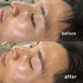 アイブロウ Akala miのエステ・リラクイメージ