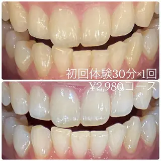 PLATINUM Beauty 横浜店所属・ホワイトニングルーム 横浜店のその他イメージ