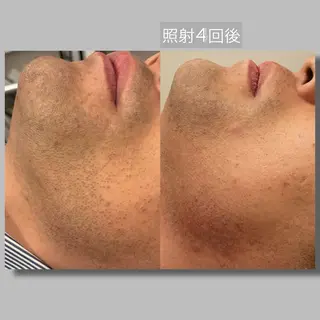 メンズ ☆痩身/小顔☆ 結果出します☆のエステ・リラクイメージ