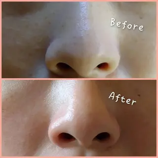 エステサロン Lazulisea所属・川口 春奈のエステ・リラクイメージ