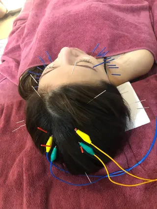 美容鍼灸女性専用 りんご鍼灸治療院のその他イメージ