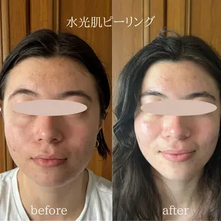 痩身/腸もみ/ ヘッドスパ/リンパのエステ・リラクイメージ