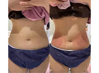 秒速小顔新宿南口 大谷のその他イメージ