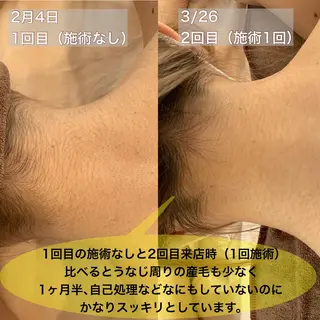 美肌コラーゲン脱毛SINCERITE【サンセリテ】所属・瀬野 のぞみのエステ・リラクイメージ
