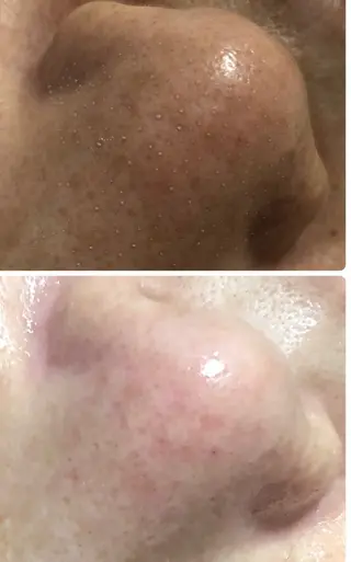 private salon Dea_maris シュガーリング&パーソナルボディケア所属・シミ改善・韓国肌管理 ボディメイク痩身のその他イメージ