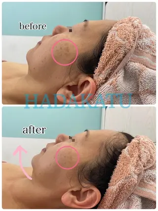 総合エステサロン 肌活のエステ・リラクイメージ