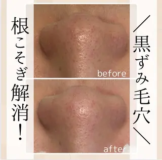 小顔・毛穴・たるみ ネイル　　似内真樹のエステ・リラクイメージ