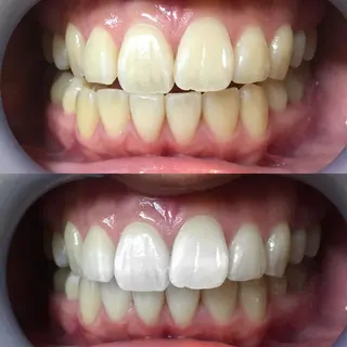 LBSホワイトニング 新宿店💝店長熊倉のその他イメージ